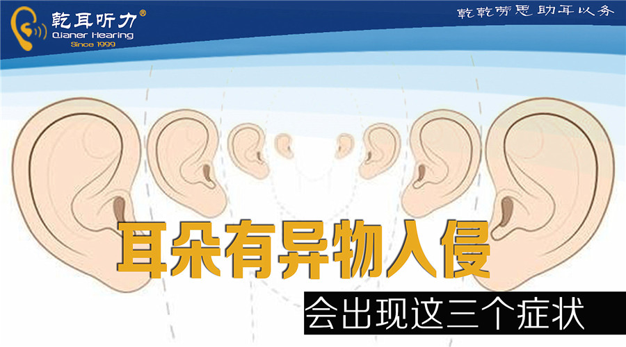 ЮF(xin)@(g)YՈr(sh)